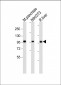 ALDH1L2 Antibody (C-term)